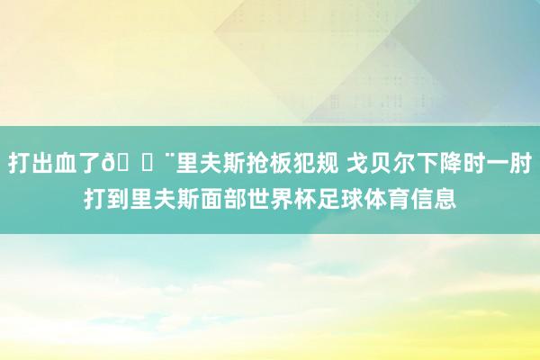 打出血了😨里夫斯抢板犯规 戈贝尔下降时一肘打到里夫斯面部世界杯足球体育信息